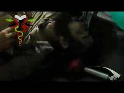 Doctors Pull out Fighters Brain Following Terrible Wound