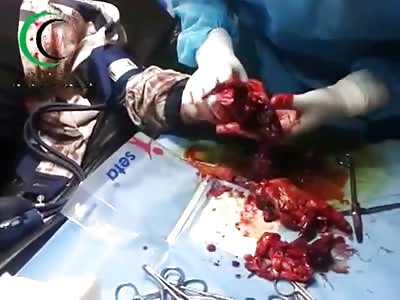 My guess is..Hes going to Lose this Hand