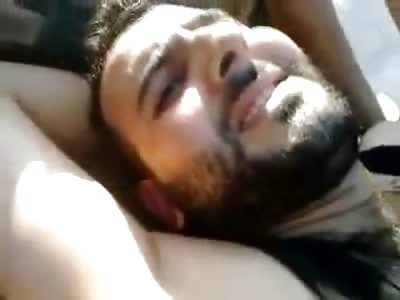 Fighters Legs are a Complete Mess