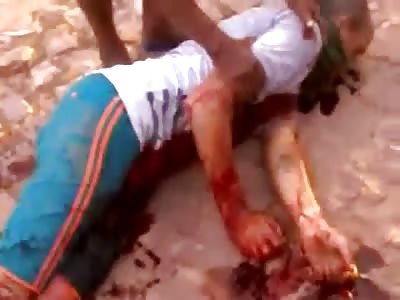 Man Slowly Bleeding out Dying in Total Agony after Bottle Broke off in his Neck