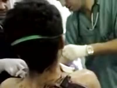 A serious blow in the throat and he still alive ! Bizzare ??