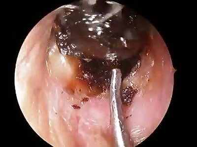 At The end of the Tunnel (An Unexpected Surprise)