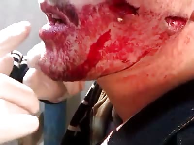 Quick vid of Bullet wound! (T&T)