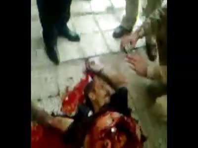 Remains of a Suicide Bomber