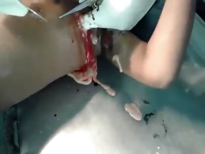 Custard kid gets drained and sliced.