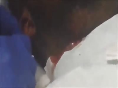 Dribbly pus chin....yummy.