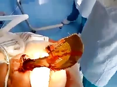 The disk in the head