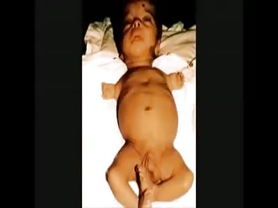 Horrible deformities