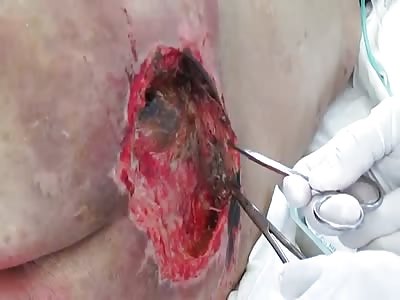 TOUCHING A SORE SPOT