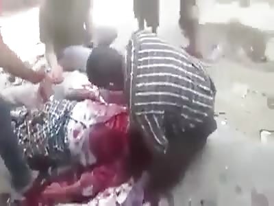 CORPSES IN YEMEN