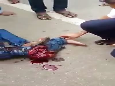 MY FRIENDS MUST SEE THIS WOUND IN FACEBOOK!