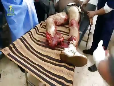 A SMALL PROBLEM ON FOOT