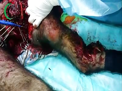 NOTHING THAT A WALKING STICK NOT SOLVE