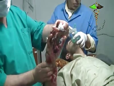 A SMALL PROBLEM IN HAND