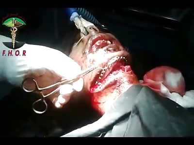 ABDULAH BRAND NEW JAW