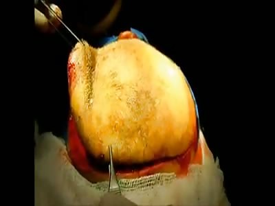 DR. SAYS THE HEADACHE STOPPED AND SHE IS FINALLY READY FOR SEX.