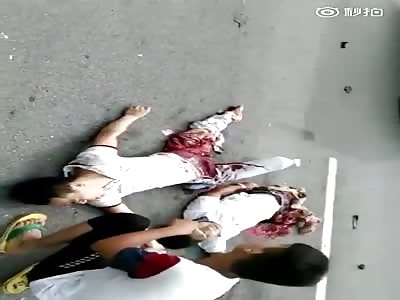 Two men gets legs crushed by vehicle 