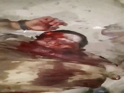  Flabby isis terrorist hunted by Iraqi Patriots  