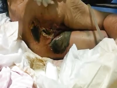 Rancid Maggoty Arse!