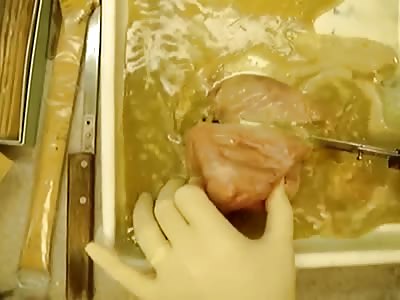 Opening a Muslim Birth Sac!