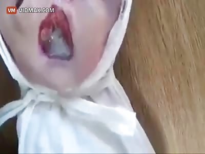 Horrifying video of a deformed baby due to chemical warfare.