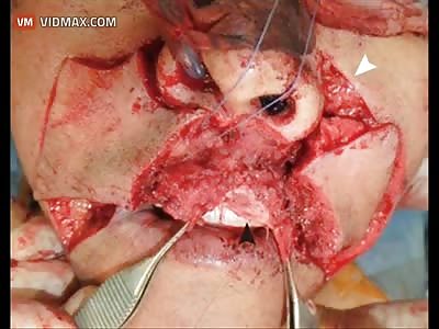 Extremely Graphic injuries